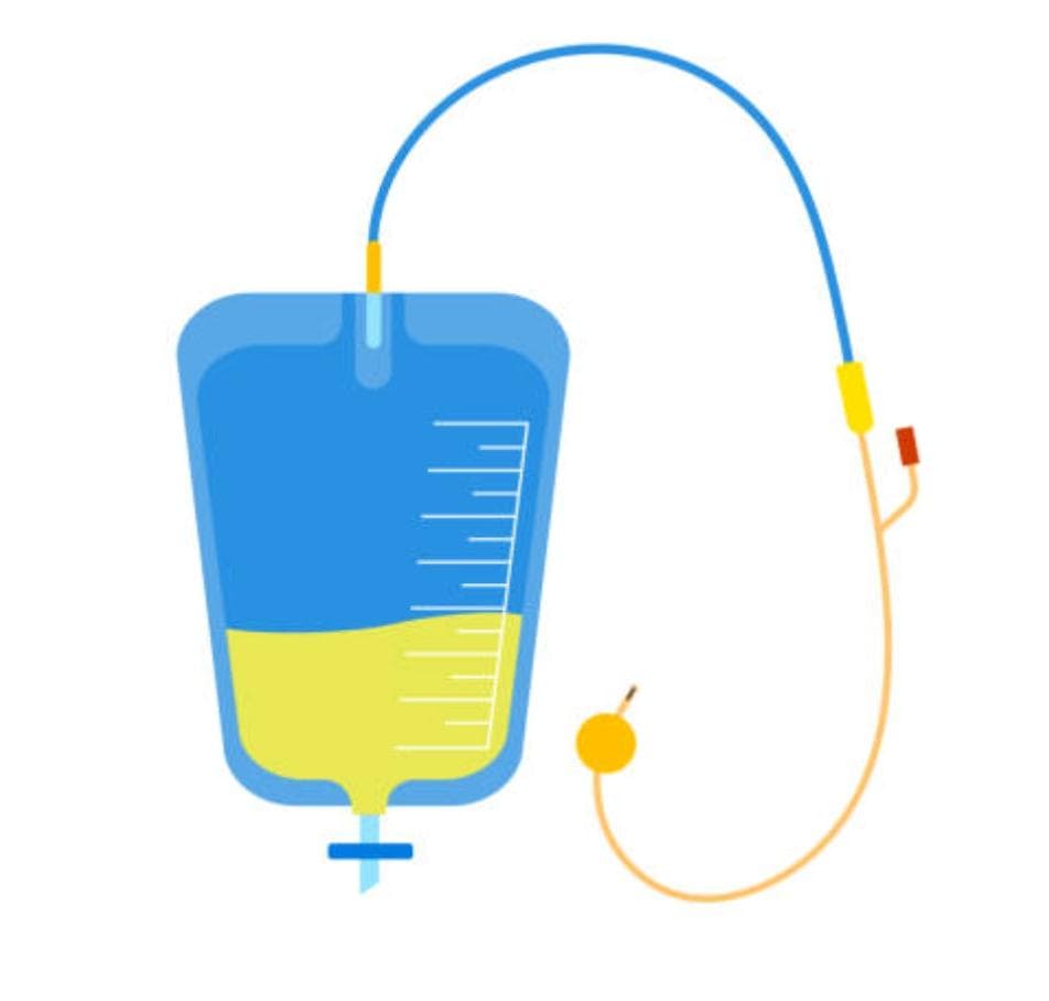 Urine Catheter (Foley's) Change